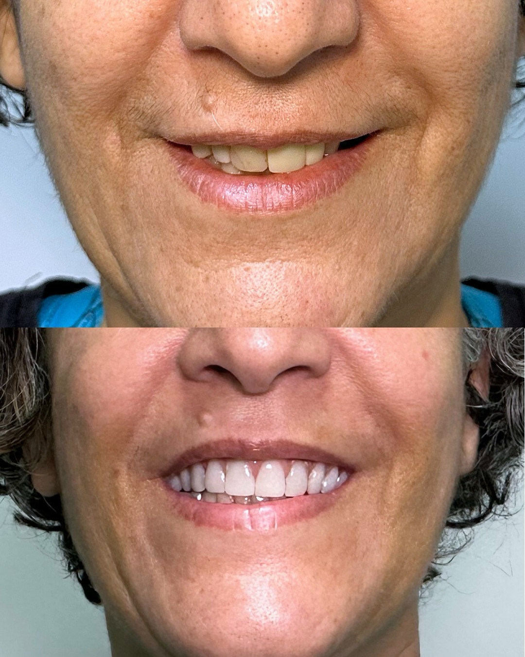 Antes e Depois — Caso 2